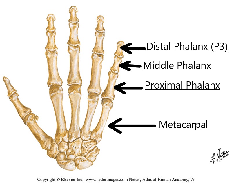 metacarpals, phalanges labeled